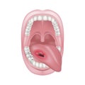 cancer of the tongue, oral cavity.